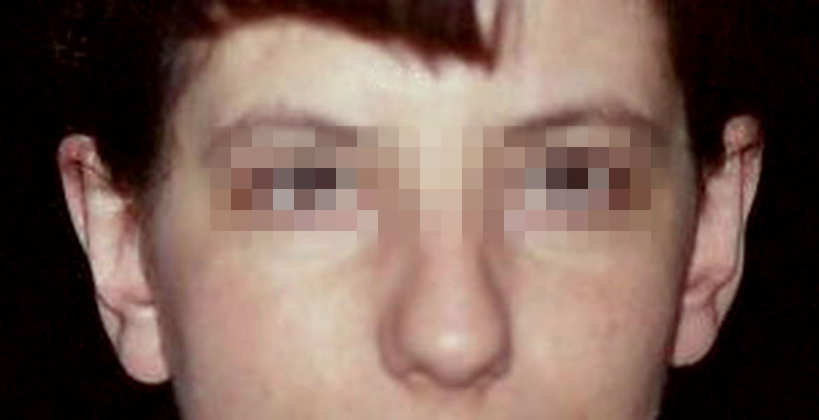 oto12blur